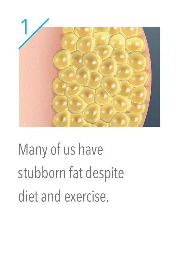 Stubborn fat cells