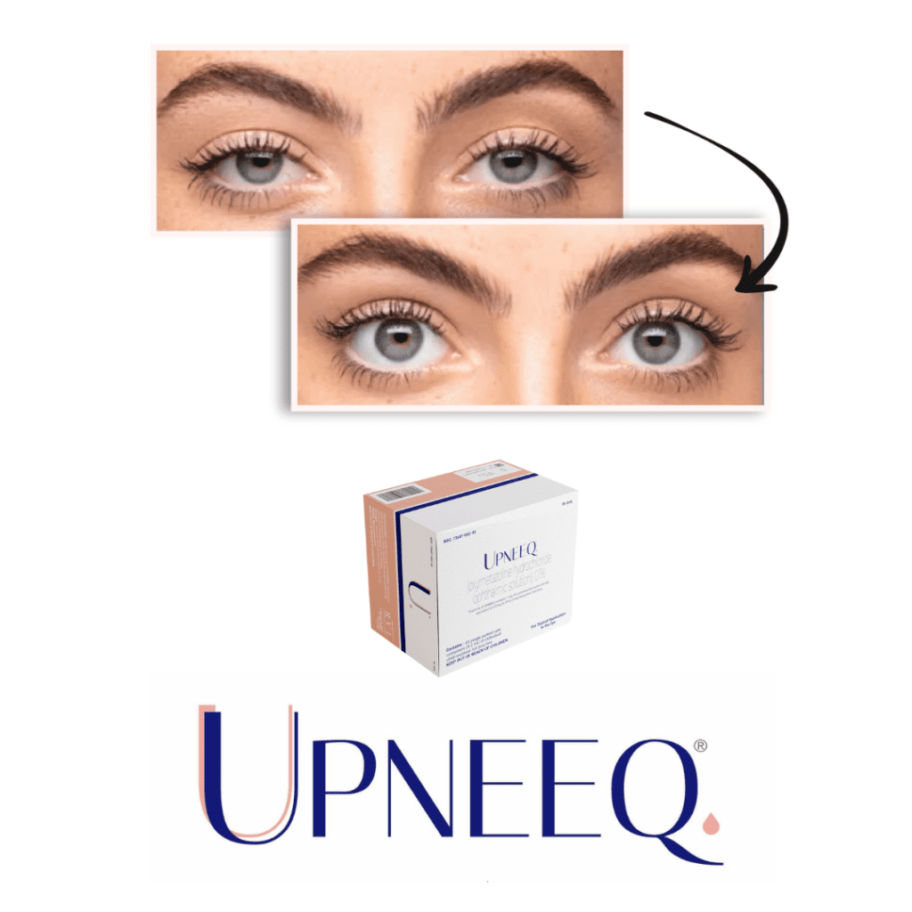 Before and after eye drop treatment with Upneeq.